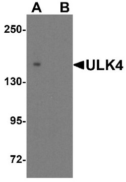 ULK4 Antibody - BSA Free, Novus Biologicals:Antibodies:Primary Antibodies